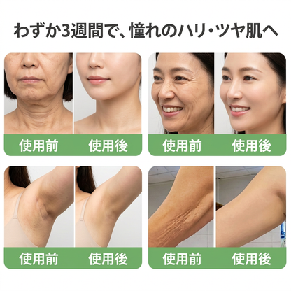 FDA登録：HISKIN® PDRN マルチペプチド ハリ・弾力コラーゲンボディオイル — エイジングケア、保湿ケア、ハリ・弾力ケア、なめらかな肌印象へ導くボディケア、肌トーンケア、ニキビ跡・乾燥による色ムラケア、肌表面の気になる部分のケア。